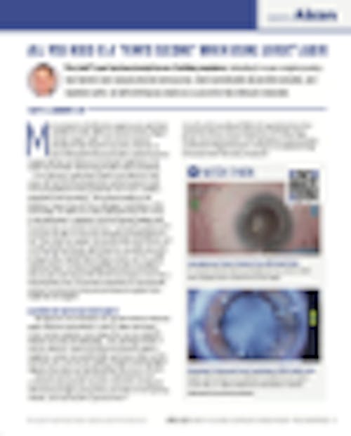 All You Need is a “Femto Second” When Using LenSx<sup>®</sup> Laser image