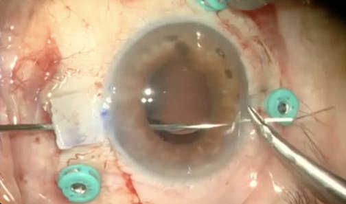 Carlevale Lens